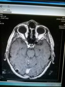 This is a picture from one of my recent MRI's